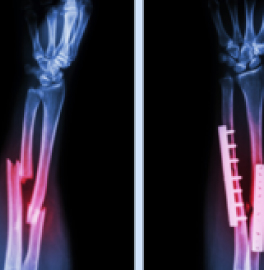 Distribuidora de las mejores marcas de material médico y equipamiento médico hospitalario